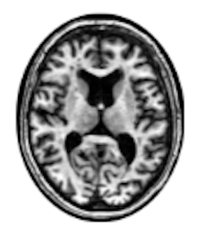 Neuroimaging (Coming 2023) Icon